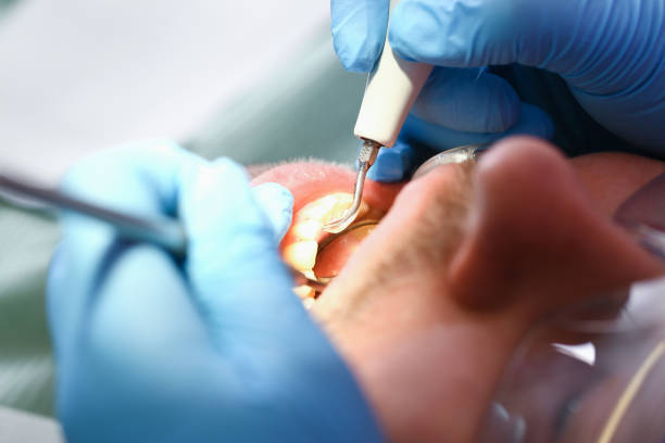 Best Emergency Treatment for Dental Infections or Abscesses in Nichols Hills, OK