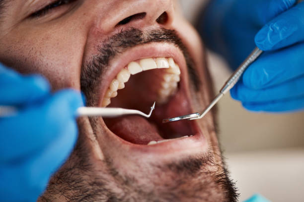 Best Urgent Care for Lost Fillings or Crowns in Nichols Hills, OK